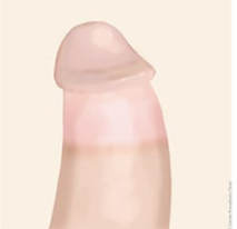 Normal circumsised penis