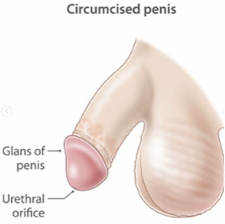Circumcised penis